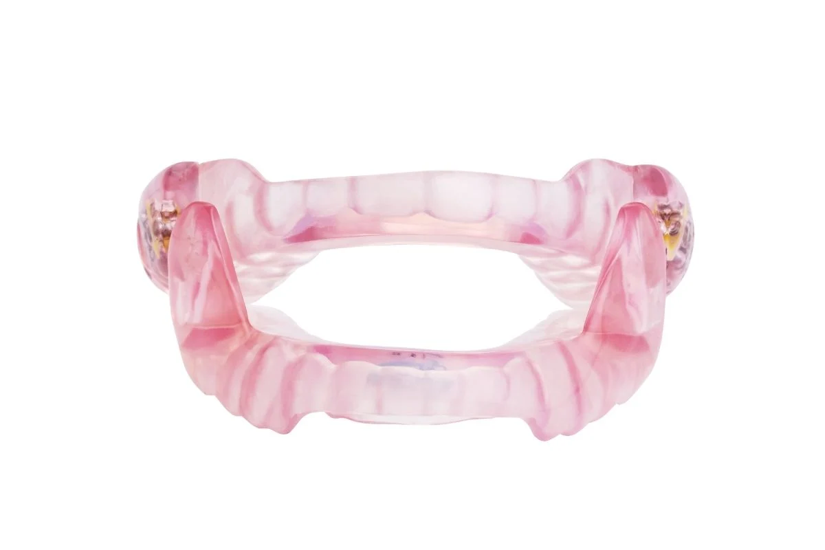 SomnoDent Flex, an den Patienten angepasste Unterkieferprotrusionsschiene (UKPS)