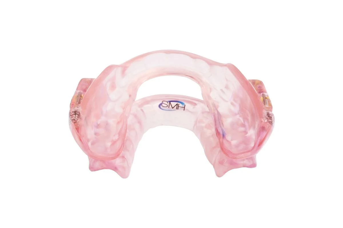 SomnoDent Fusion, an den Patienten angepasste Unterkieferprotrusionsschiene